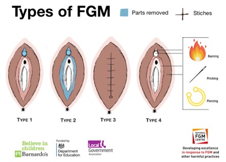 Types of FGM